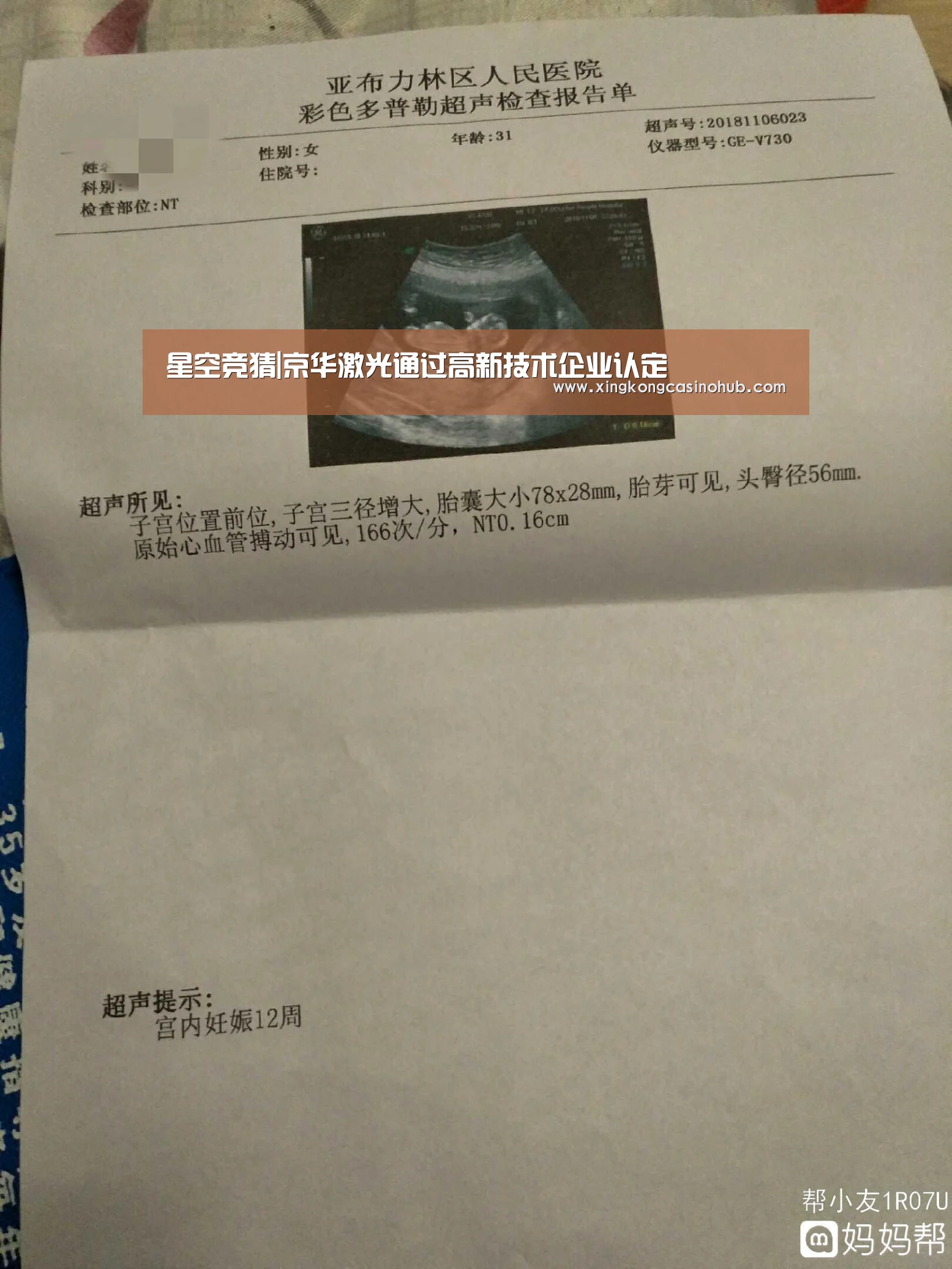 星空竞猜|京华激光通过高新技术企业认定(图2) 星空体育